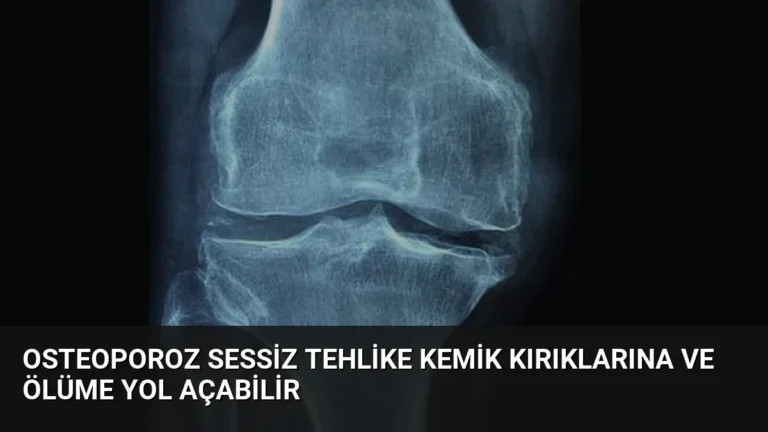 Osteoporoz Sessiz Tehlike Kemik Kırıklarına ve Ölüme Yol Açabilir