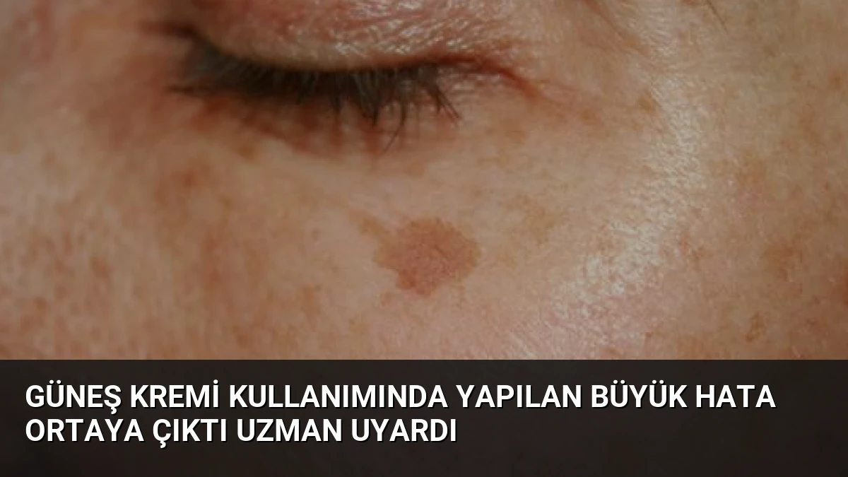Güneş Kremi Kullanımında Yapılan Büyük Hata Ortaya Çıktı Uzman Uyardı
